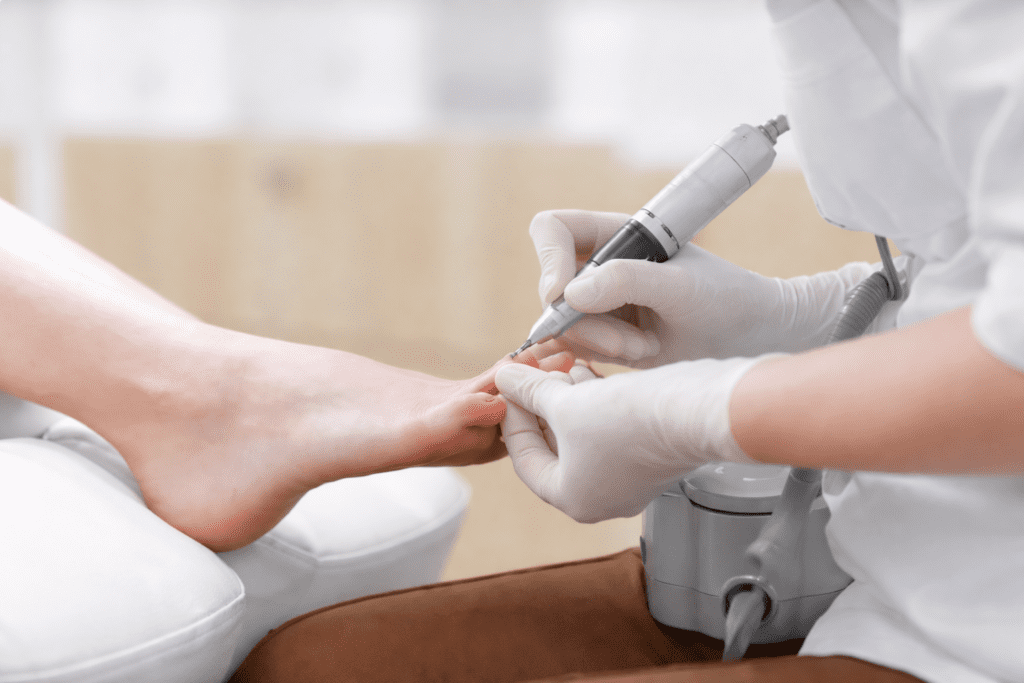 Sessão de Podologia