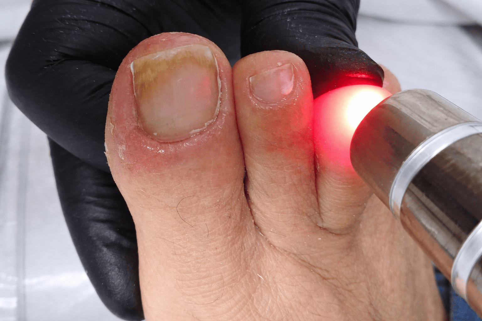 Clínica de Podologia e Acupuntura a Laser em Campinas