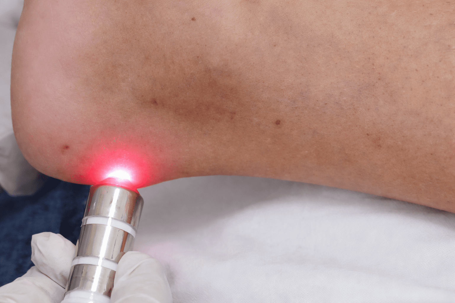 Clínica de Podologia e Acupuntura a Laser em Campinas