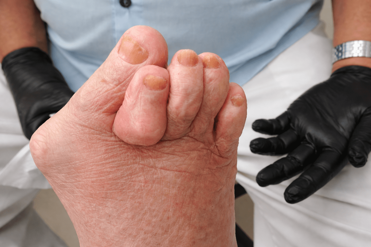 Clínica de Podologia e Acupuntura a Laser em Campinas