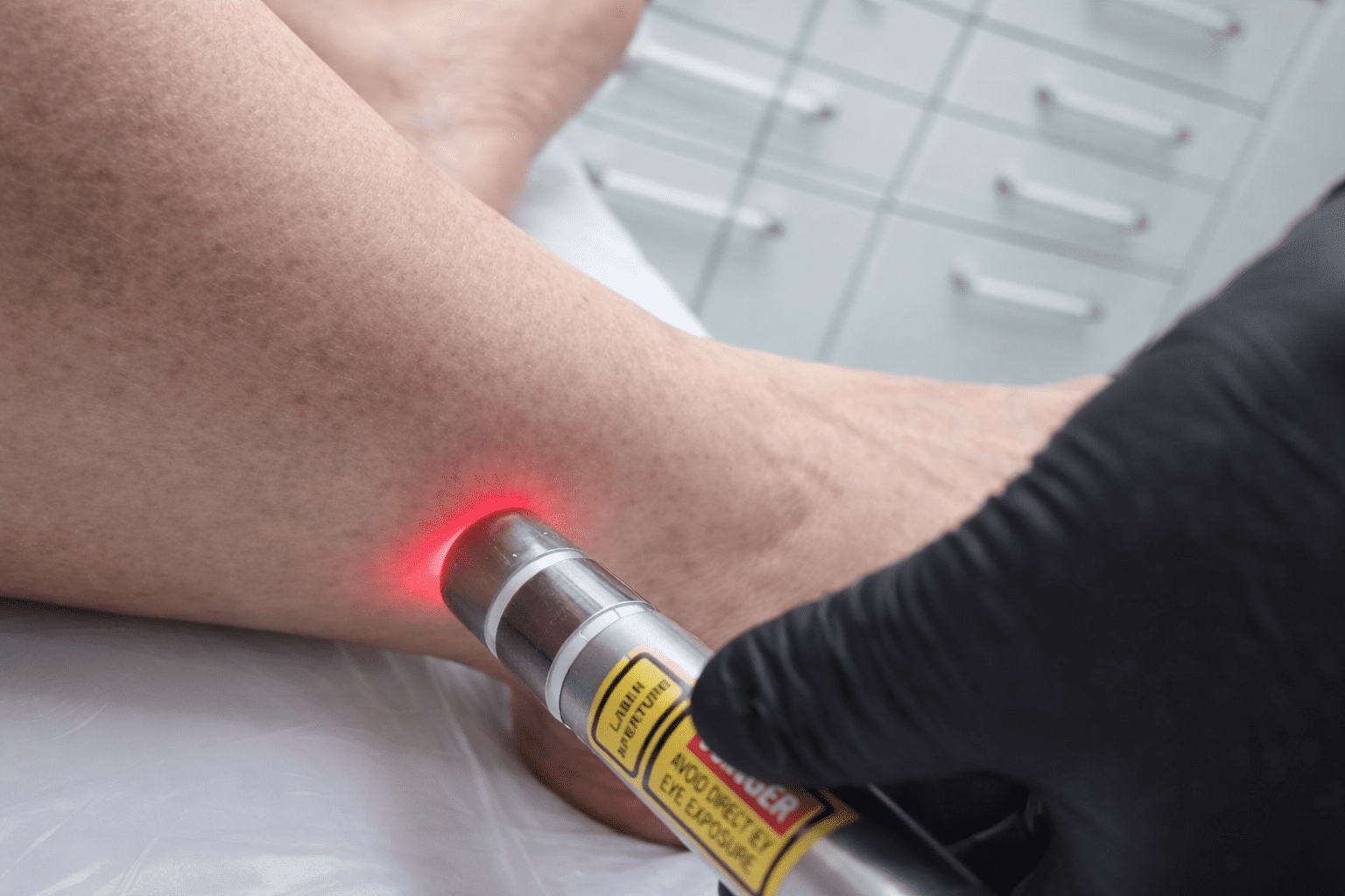 Clínica de Podologia e Acupuntura a Laser em Campinas