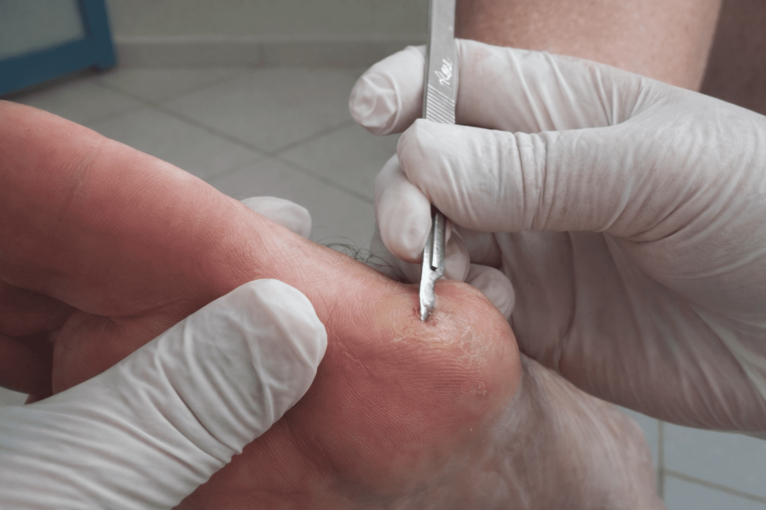 Clínica de Podologia e Acupuntura a Laser em Campinas