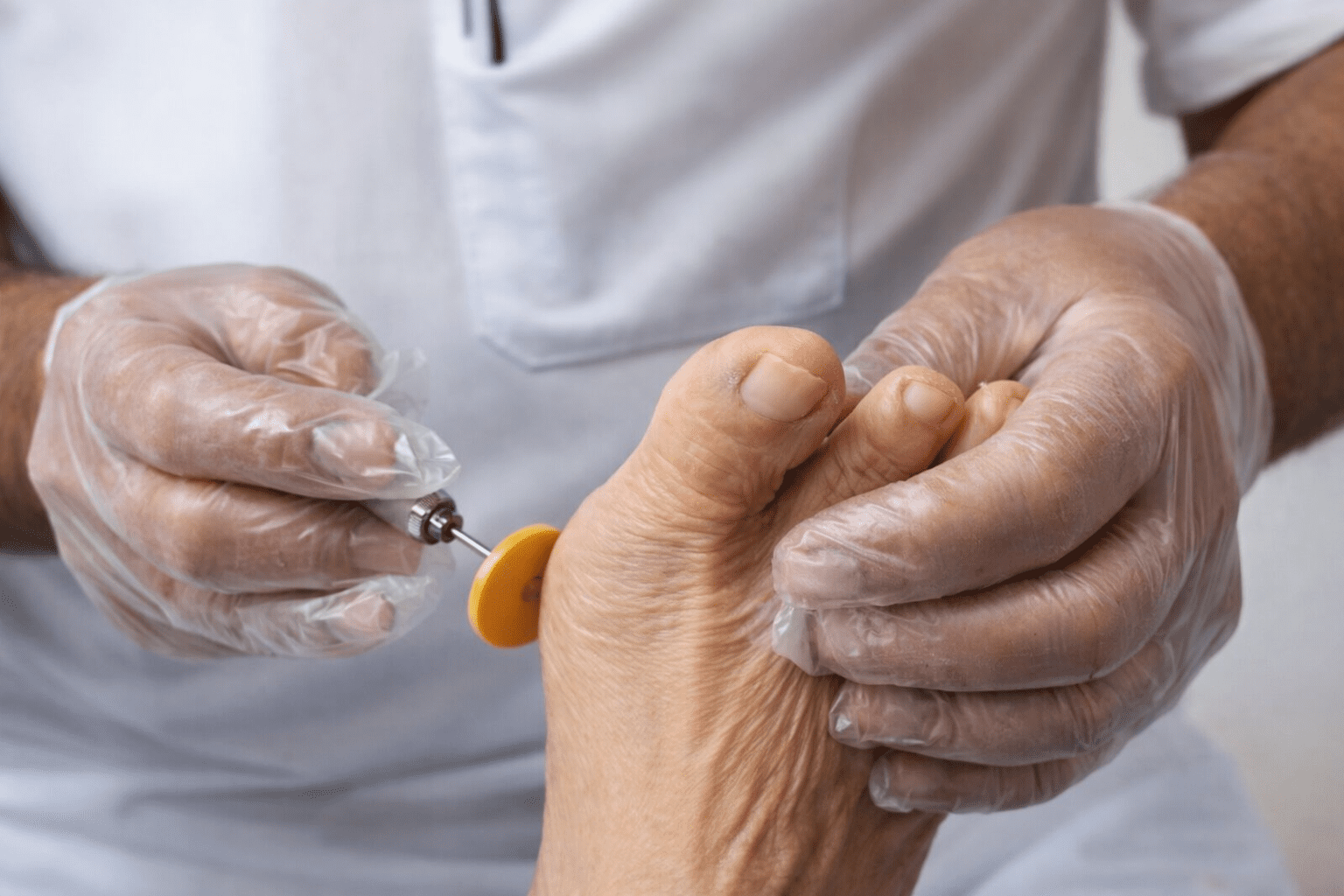 Clínica de Podologia e Acupuntura a Laser em Campinas